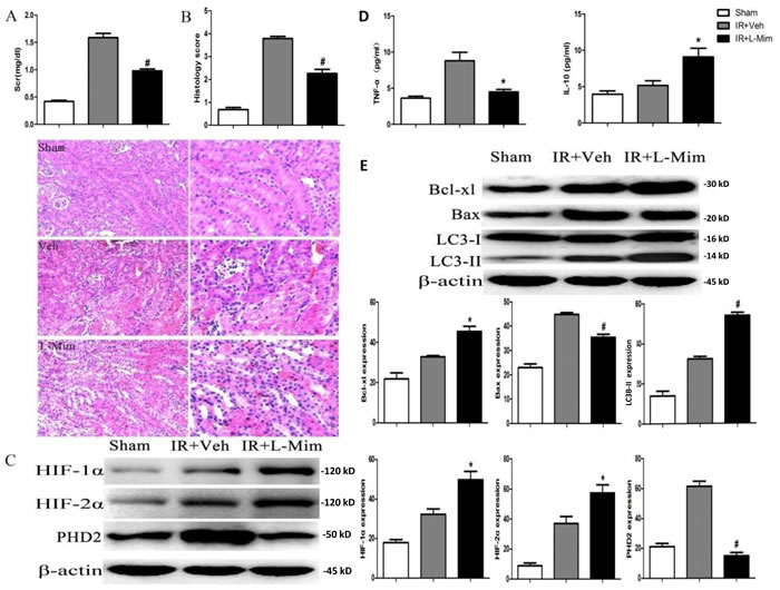L-mimosine administration attenuates renal ischemia-reperfusion injuries.