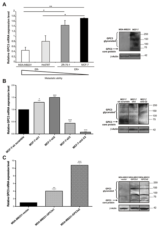 GPC3 expression in breast cancer cell lines.