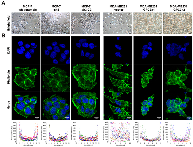 Effect of GPC3 on cell morphology and actin cytoskeleton organization.