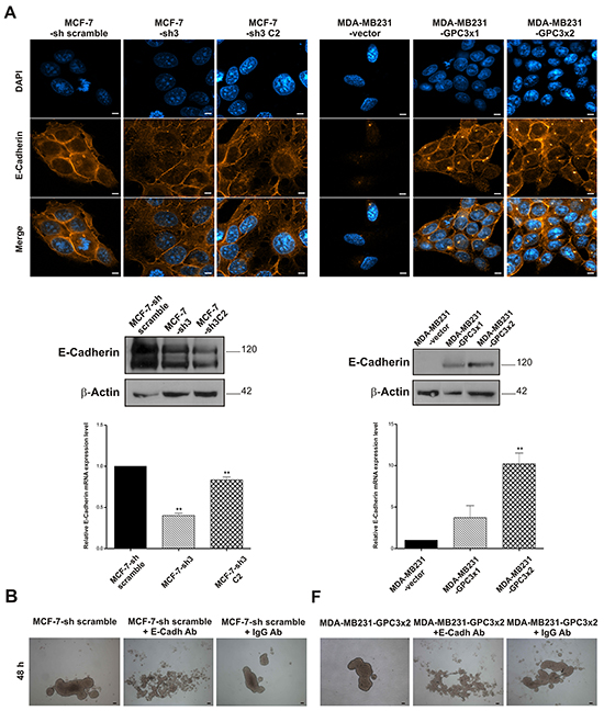 Effect of GPC3 on the expression of the epithelial marker E-Cadherin.
