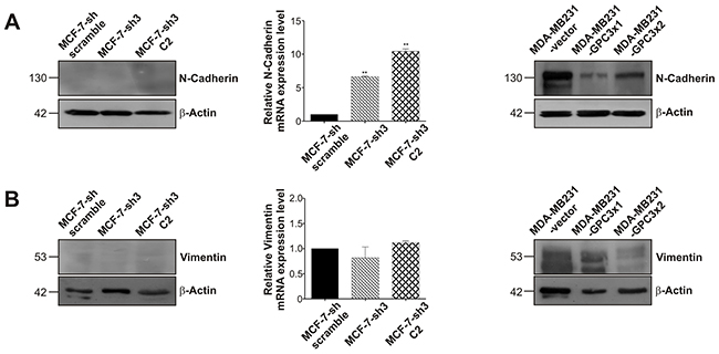 Effect of GPC3 on the expression of the mesenchymal markers N-Cadherin and vimentin.