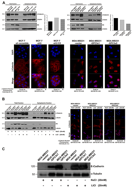 Effect of GPC3 on the canonical Wnt/&#x03B2;-Catenin signaling pathway activity.