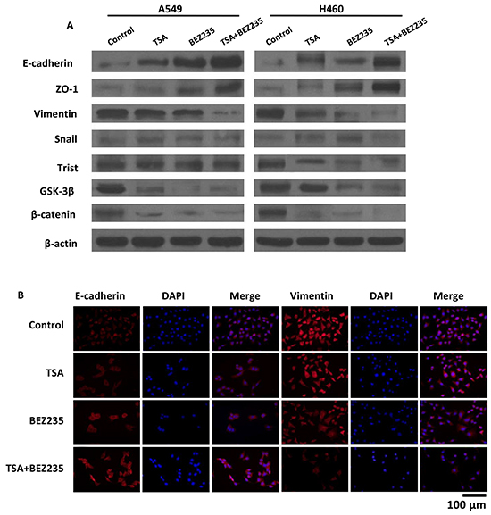 BEZ235 and TSA synergistically suppressed the EMT progression of A549 cells.