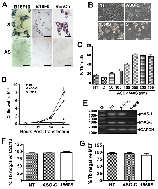 ASK induces death and proliferative index decrease in B16F10 cells.