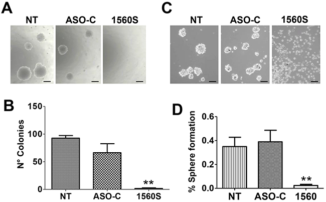 ASK reduces tumorigenic and invasive potential of B16F10 cells.
