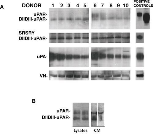 Bone marrow stroma cells express uPAR and its ligands.