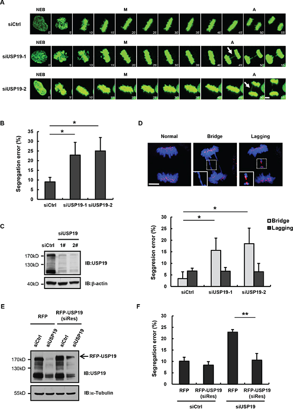 Knockdown USP19 induces the formation of anaphase bridge.