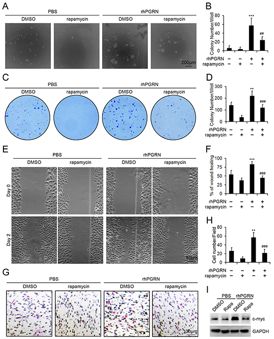 Rapamycin inhibited the transformation of H8 cells treated with rhPGRN.