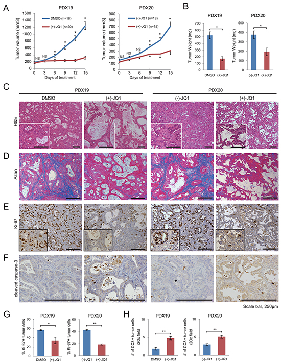 JQ1 attenuates tumor growth and desmoplasia in PDX of human PDAC.