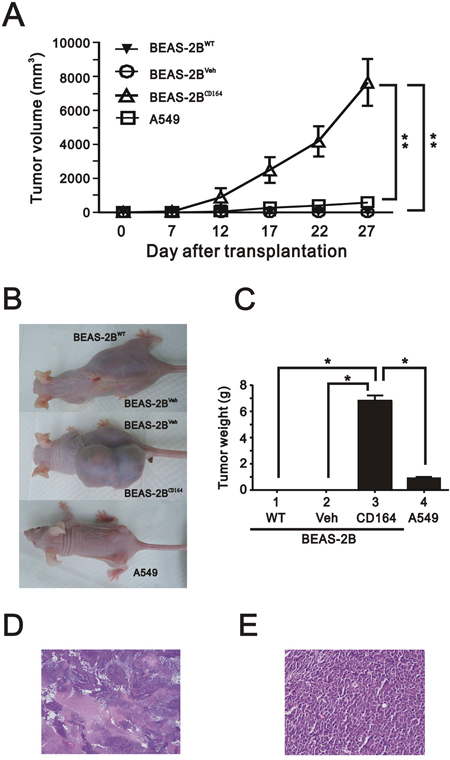 The effect of overexpression of CD164 on tumorigenicity in the xenografted mice.
