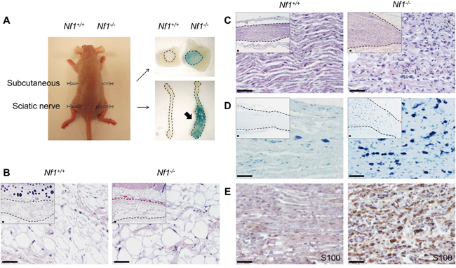 Nf1-/- SKPs give rise to classic neurofibroma in sciatic nerve but not in subcutaneous tissue.