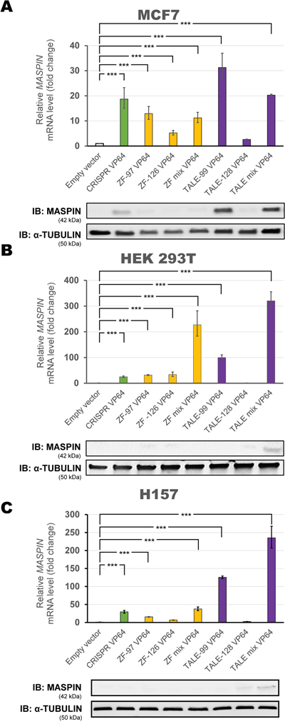 Transient transfection of individual ATFs up-regulates MASPIN expression.