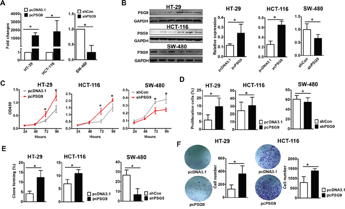 PSG9 promotes the proliferation and migration of CRC cells.