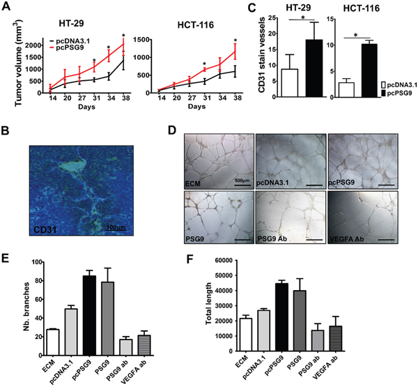PSG9 promotes tumor proliferation in vivo and enhances angiogenesis in vivo and in vitro.