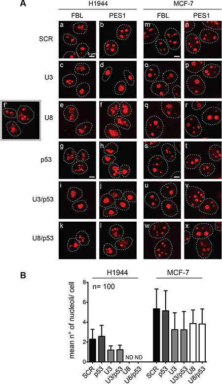Effects of U3 and U8 depletion on nucleolar structure.