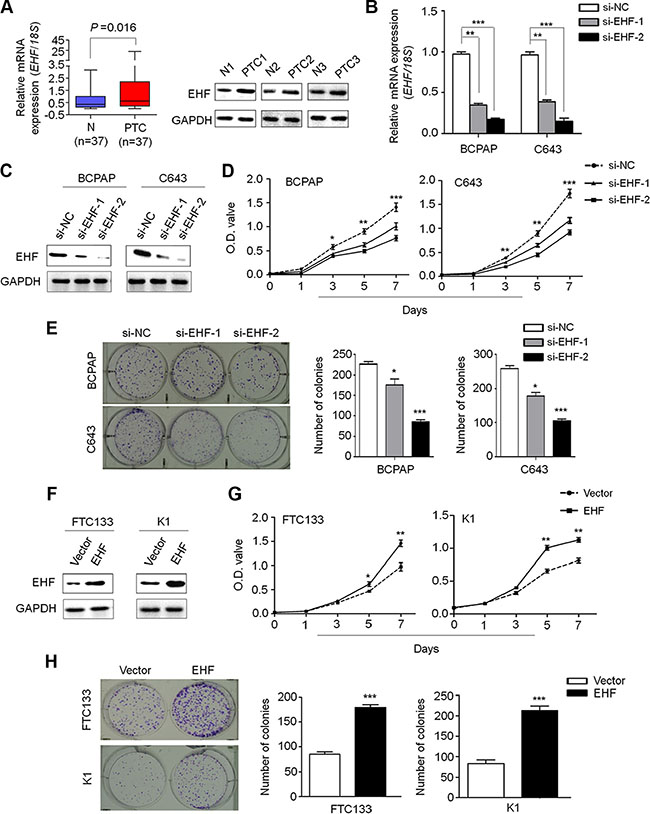 Increased expression of EHF promotes thyroid cancer cell proliferation and colony formation.