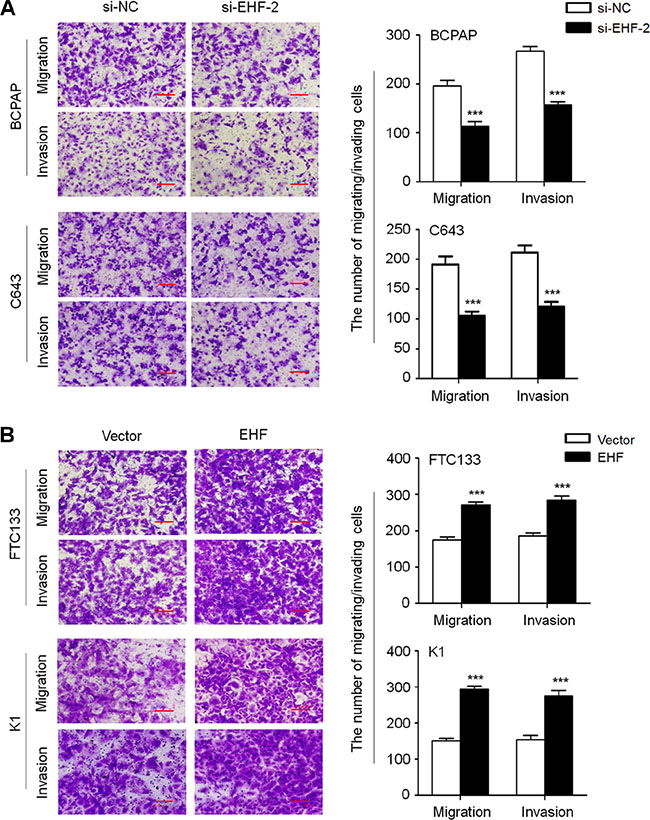 EHF knockdown inhibits thyroid cancer cell migration and invasion.