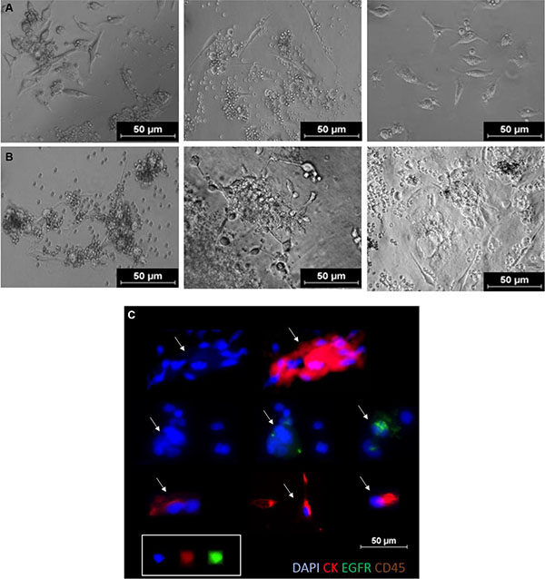 Short term CTC cultures in 2D (MSK media, day 7, 2% O2).