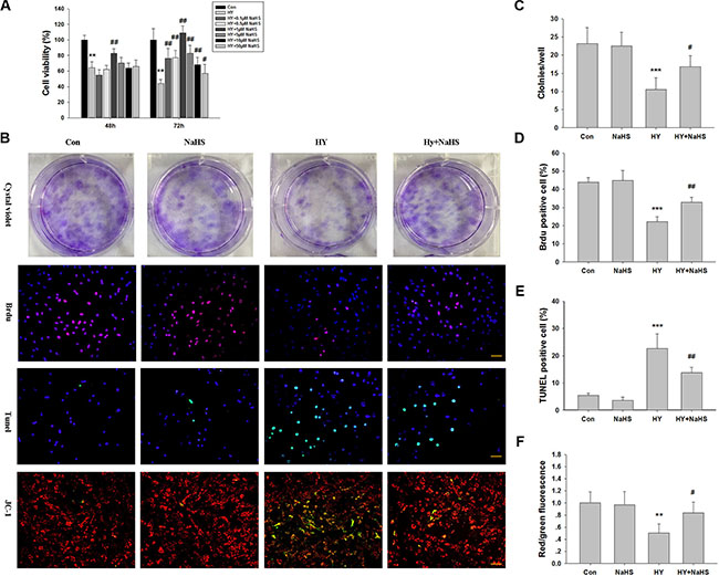 Effects of NaHS treatment on cell viability in bone marrow mesenchymal stem cells (BMSCs) in vitro.