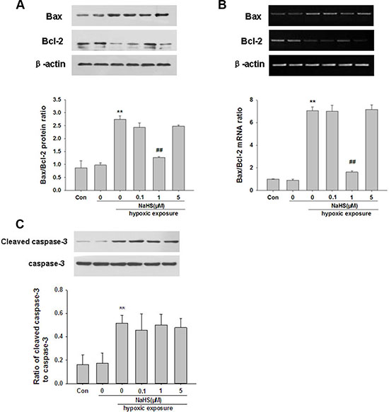 NaHS reverses hypoxia--ischemic induced changed of Bax and Bcl-2 and caspase-3 activation in BMSCs in vitro.