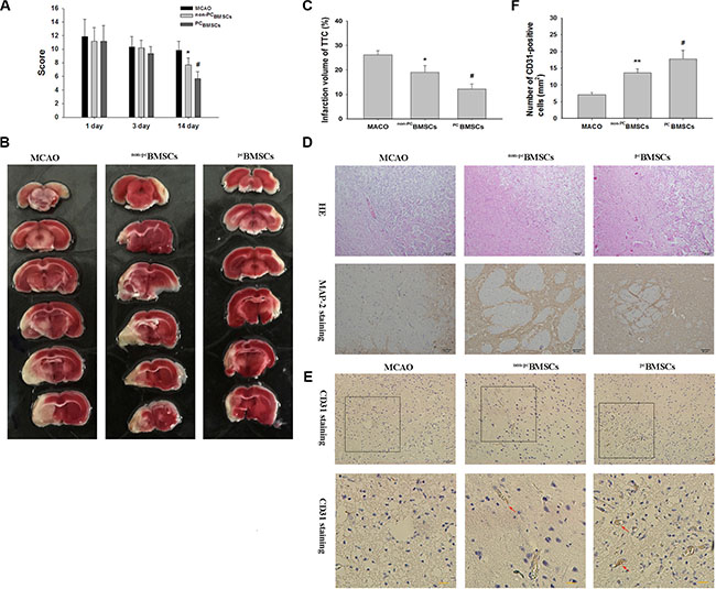 Administration of NaHS preconditioned-BMSCs (PCBMSCs) improved neurological function, decreased infarct volume, promoted neuronal density and MAP-2-positive cells in the infarct area.