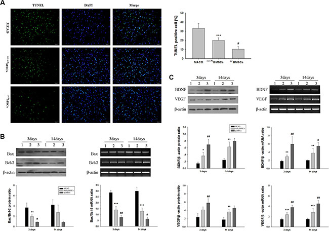 Administration of PCBMSCs alleviated MACO-induced apoptosis, decreased Bax/Bcl-2 ratio and increased BDNF and VEGF expression.