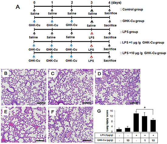 GHK-Cu attenuated LPS-induced acute pulmonary inflammation in mice.