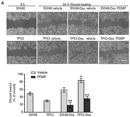 Effect of p53 R273H mutant on wound healing of colon cancer cells.