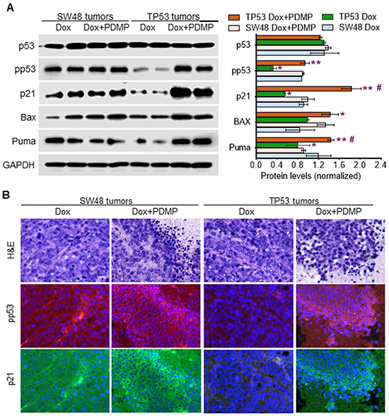 Inhibition of GCS restored p53 expression in tumors of mice during doxorubicin treatments.