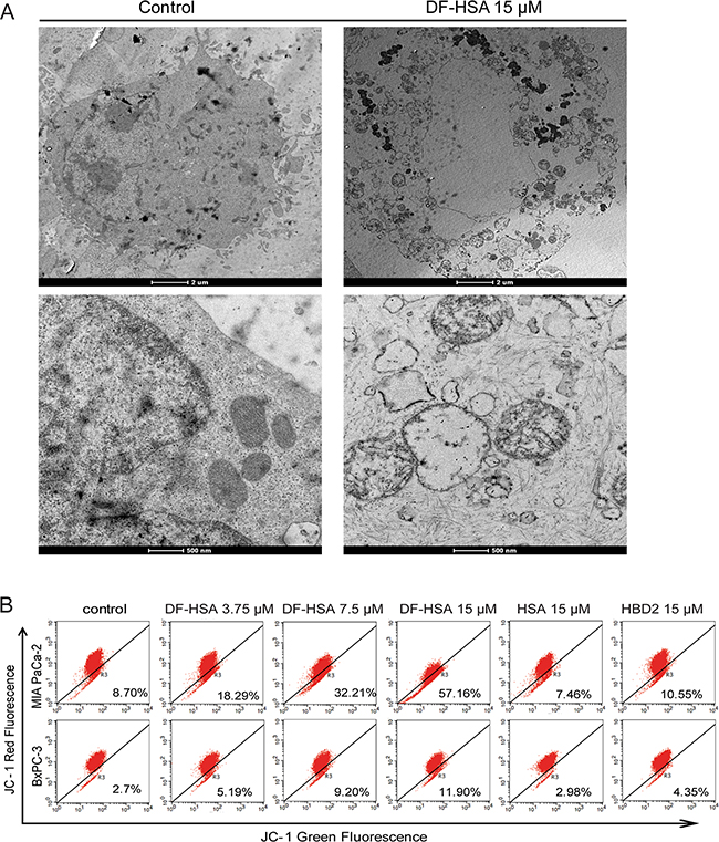 Effects of DF-HSA on ultrastructure and mitochondrial membrane potential in human pancreatic carcinoma cells.