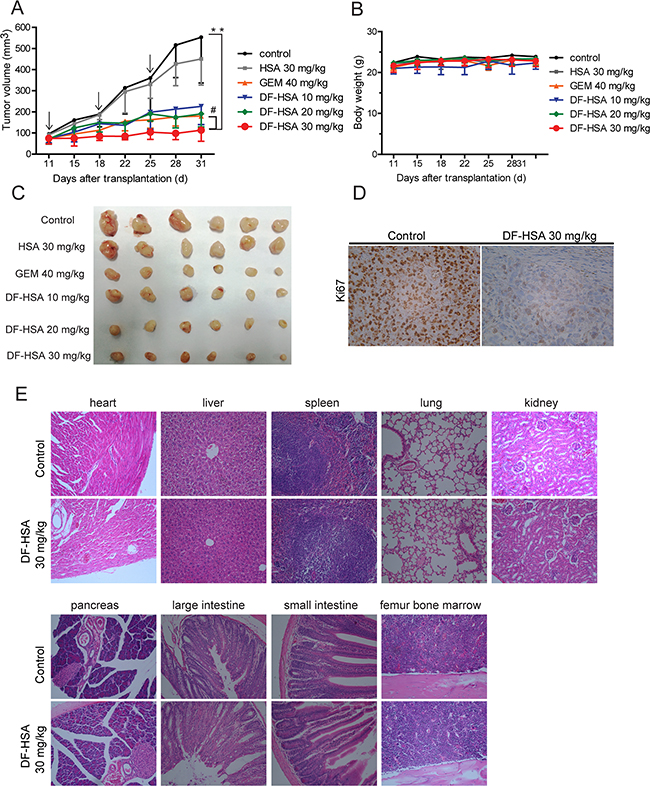 Therapeutic efficacy of DF-HSA against pancreatic carcinoma MIA PaCa-2 xenograft in athymic mice.