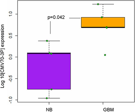 Cytomegalovirus expresses viral miRNAs in the neoplastic tissue of glioma patients.