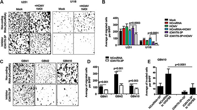 Enforced inhibition of CMV70-3P reduces migration and invasion of glioma cells.