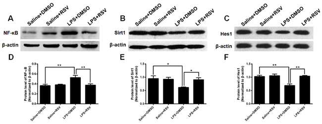 Expression of NF-&#x3ba;B, Sirt1, and Hes1 in the mouse hippocampus.