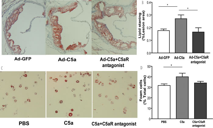 Effect of C5a overexpression on lipid deposition.