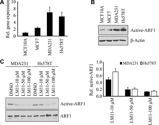 LM11 inhibits ARF1 activation in breast cancer cells.