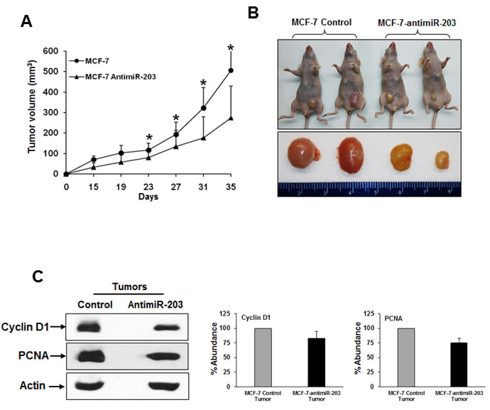 Inhibition of miR-203 in MCF-7 cells nude mice reduces tumor growth in nude mice.