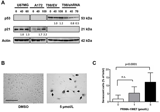 PRIMA-1MET treatment increased p21 and senescent phenotype in wtp53 MGMT-negative GBM cells.