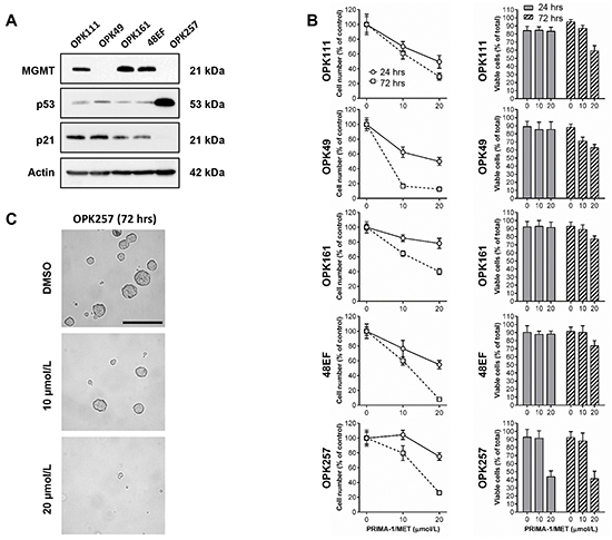 PRIMA-1MET decreased relative cell number of GSCs irrespective of p53 status.