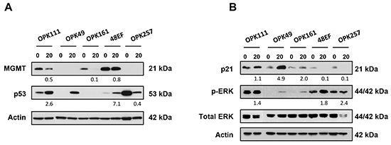 PRIMA-1MET modulated expression of wt and mutp53, MGMT, p21 and phosphorylated forms of Erk1/2 in GSCs.