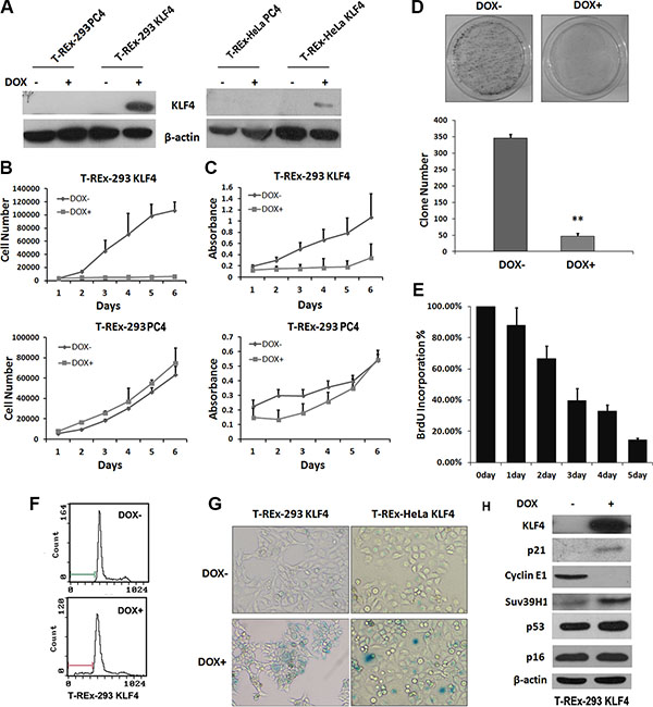 Overexpression of KLF4 induced cellular senescence in epithelial cells.