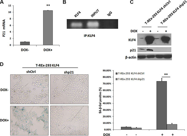 p21 expression increased in KLF4-induced senescence.