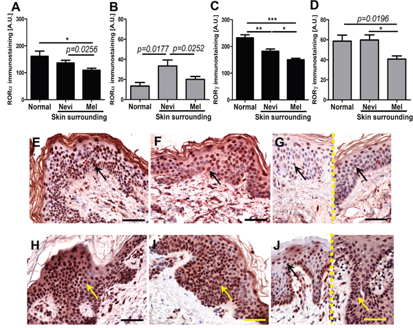 The mean level of nuclear (A, C) and cytoplasmic (B, D) ROR&#x03B1; (A, B) and ROR&#x03B3; (C, D) in keratinocytes of normal skin and keratinocytes of skin surrounding melanocytic nevi and melanomas.