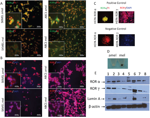 Changes in ROR&#x03B1; and ROR&#x03B3; expression pattern in cultured melanoma cells after induction of melanogenesis.