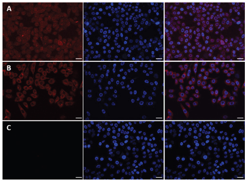 Laser scanning confocal microscopy (LSCM) images of A549 cells incubated with free DOX