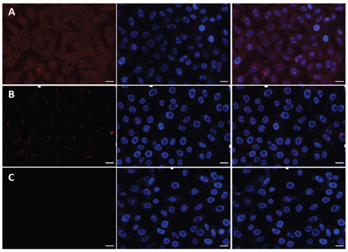 Laser scanning confocal microscopy (LSCM) images of MCF-7 cells incubated with free DOX