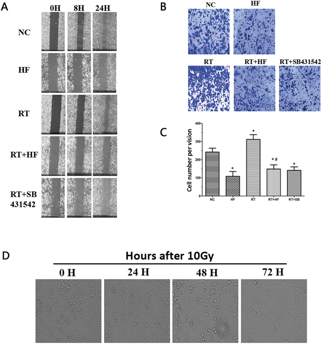 Migration and wound healing assays.