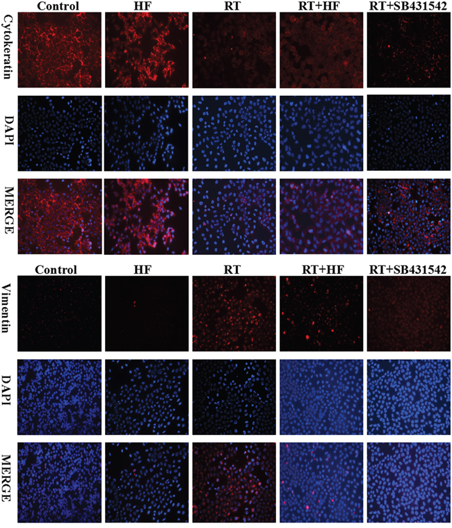 Cytokeratin and vimentin expression in LLC cells.