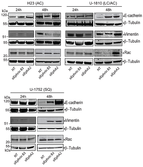 Down regulation of Ephrin B3 and EphA2 in NSCLC alter EMT marker expression.