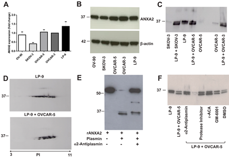 Annexin A2 expression in ovarian cancer cell lines, peritoneal cell line and co-cultured ovarian cancer and peritoneal cells.